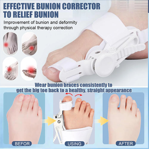 Correcteur d'orteils réglable unisexe, attelles d'hallux Valgus, séparateur d'orteils rotatif, lisseur pour pied gauche et droit SUN N.