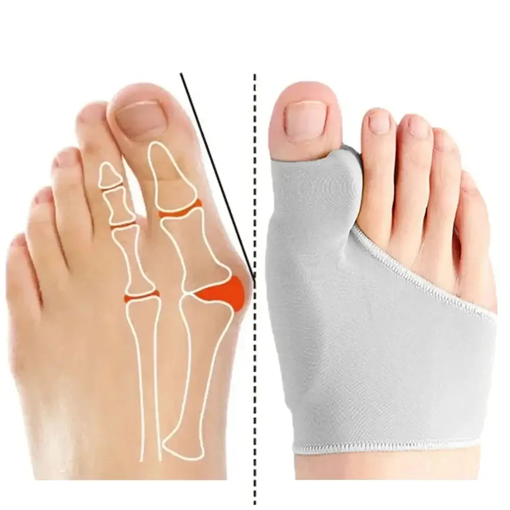 Correcteur d'Oignon et Séparateur d'Orteils – Soulagement Hallux