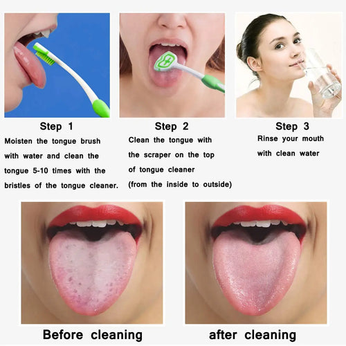 Nettoyeurs de langue en Silicone réutilisables pour adultes et enfants, brosse grattoir lavable, outil de nettoyage de la langue, haleine fraîche, hygiène buccale, 1/4 pièces SUN N.