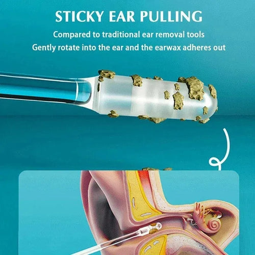 Pelle d’Oreille Collante – Outil Nettoyage Cire Doux & Précis, Alternative Coton-Tige SUN N.