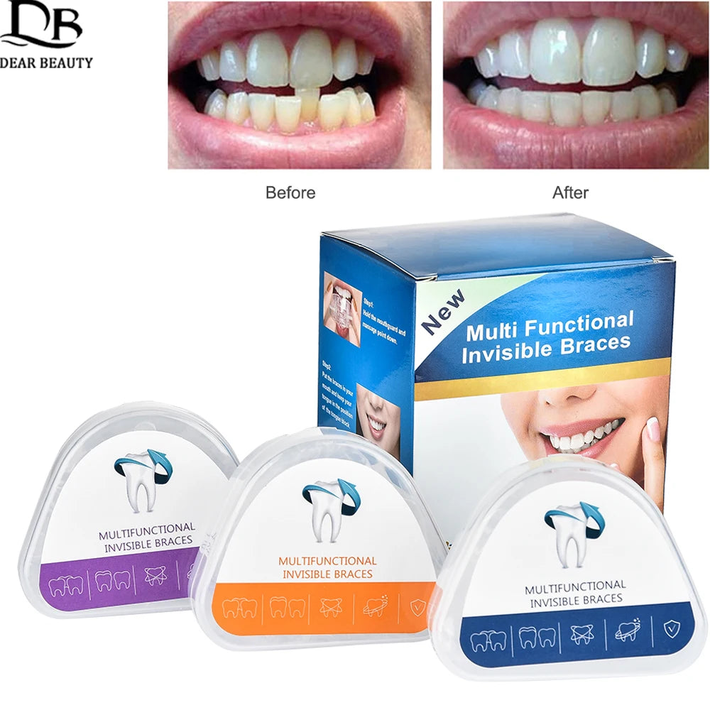 Appareil dentaire transparent 3 étapes avant et après usage, comprenant trois dispositifs d'alignement pour un sourire parfait.