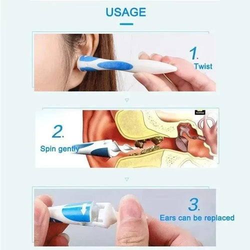 Nettoyeur d’Oreille en Silicone Souple – 16 Embouts, Extraction Cire Douce & Précise SUN N.