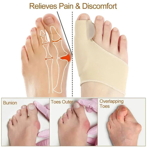 bunion corrector toe separator for hallux valgus