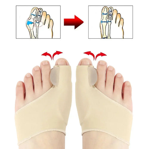 bunion corrector toe separator for hallux valgus