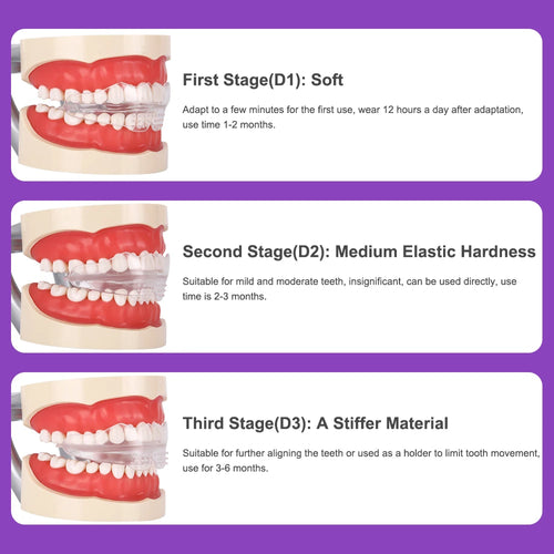 Appareil dentaire en 3 étapes, entraîneur de dents pour adultes, attelle d'alignement orthodontique, correcteur Transparent, accessoires de dentiste SUN N.