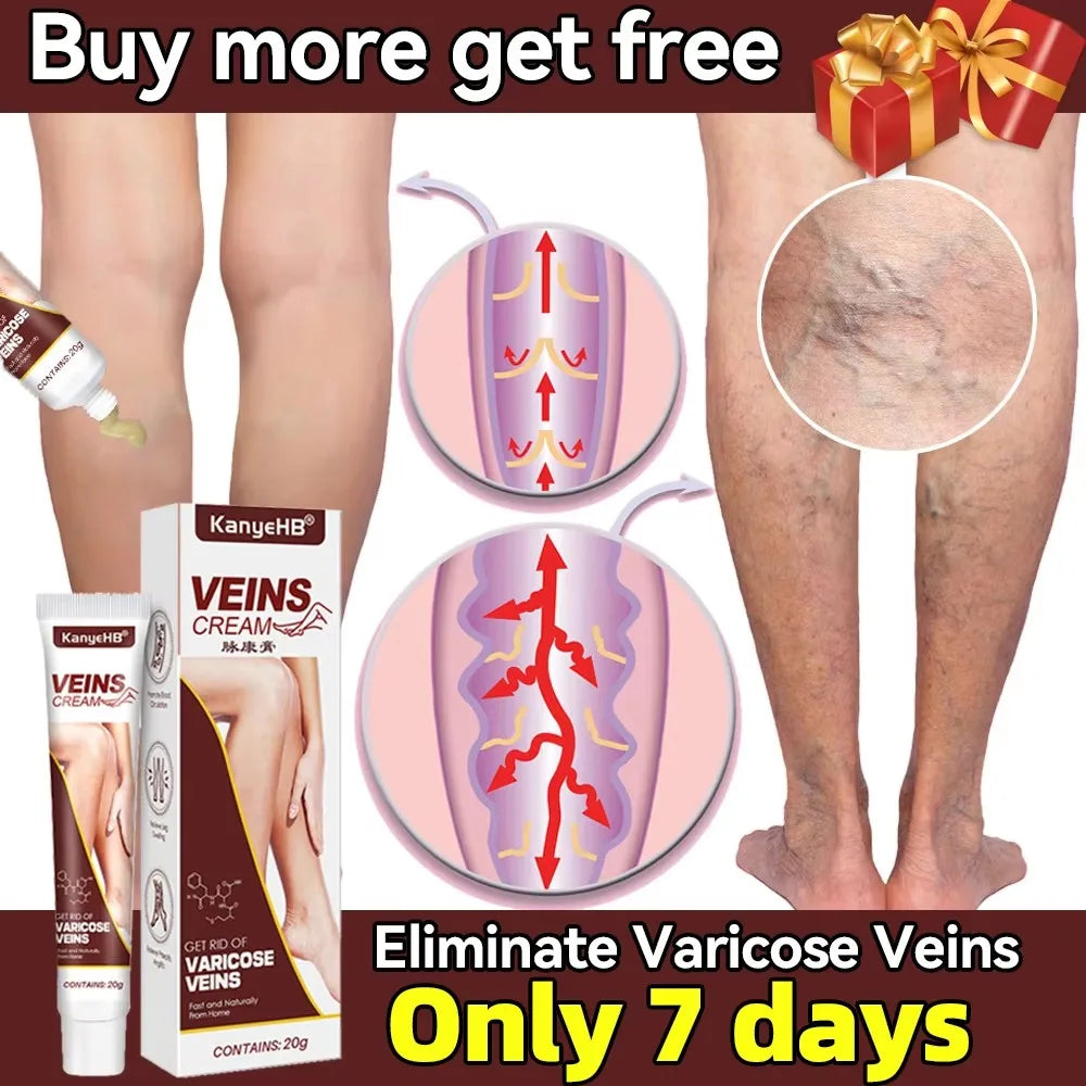 Crème traitement des varices pour soulager les varices, phlébite et améliorer la circulation